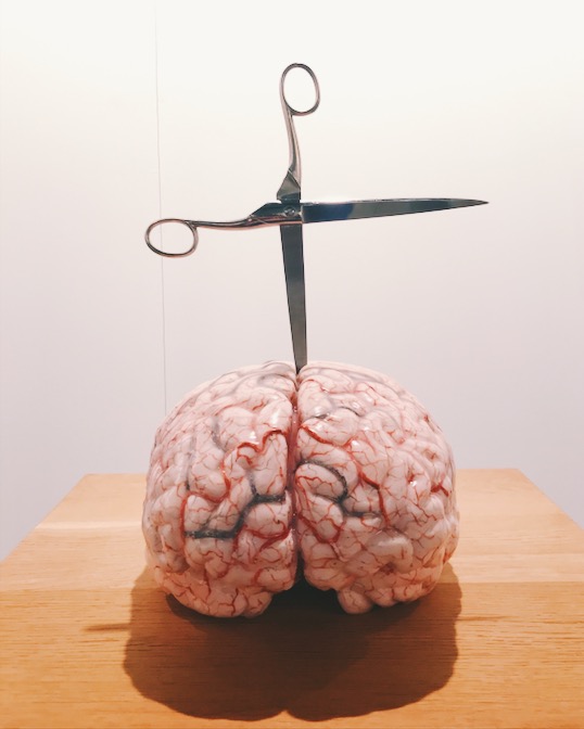 Jan Fabre. Brain with Star (2012).